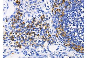 ABIN6259851 and ABIN6278727 at 1/100 staining Rat ovarian tissue by IHC-P. (AKAP12 Antikörper  (C-Term))