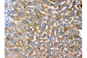 Immunohistochemistry (IHC) image for anti-Progesterone Receptor Membrane Component 1 (PGRMC1) (AA 67-102), (Middle Region) antibody (ABIN3043899)