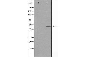 Western blot analysis of GORASP2 expression in HeLa cell extracts.