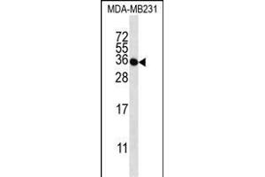 Western Blotting (WB) image for anti-Taste Receptor, Type 2, Member 1 (TAS2R1) (AA 267-296), (C-Term) antibody (ABIN656905)