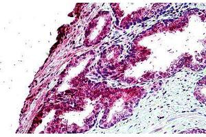 Human Prostate: Formalin-Fixed, Paraffin-Embedded (FFPE) (TBC1D10A Antikörper  (AA 2-14))