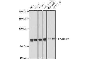Western Blotting (WB) image for anti-Cadherin 1, Type 1, E-Cadherin (Epithelial) (CDH1) (AA 700-800) antibody (ABIN6138279)