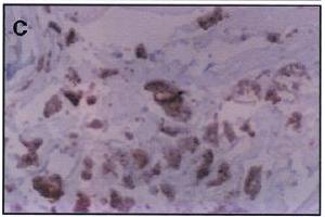 Immunohistochemistry image of dihydropyridine adduct staining in paraffn section of human atherosclerotic aorta. (Malondialdehyde Antikörper)