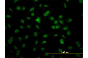 Immunofluorescence of monoclonal antibody to RBBP4 on HeLa cell. (Retinoblastoma Binding Protein 4 Antikörper  (AA 316-426))