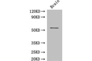 Western Blot Positive WB detected in: Mouse brain tissue All lanes: ASH2L antibody at 3 μg/mL Secondary Goat polyclonal to rabbit IgG at 1/50000 dilution Predicted band size: 69, 57, 61 kDa Observed band size: 69 kDa (ASH2L Antikörper  (AA 1-534))