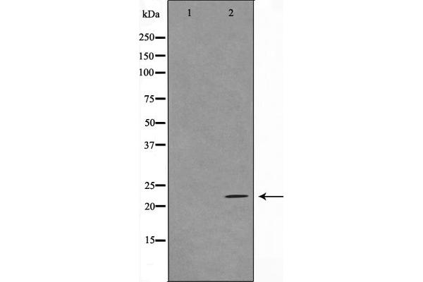 TNFAIP8 Antikörper  (Internal Region)