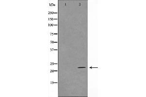 Western blot analysis on HuvEc cell lysate using TFIP8 Antibody,The lane on the left is treated with the antigen-specific peptide. (TNFAIP8 Antikörper  (Internal Region))