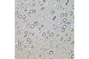Immunohistochemistry of paraffin-embedded rat brain using MAP1B antibody (ABIN1873595) at dilution of 1:100 (40x lens).