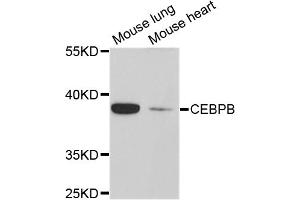 Western blot analysis of extracts of various cell lines, using CEBPB antibody. (CEBPB Antikörper)