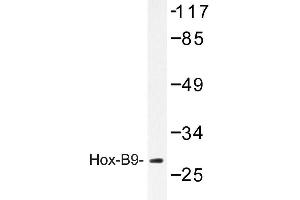 Image no. 1 for anti-Homeobox B9 (HOXB9) antibody (ABIN272173) (HOXB9 Antikörper)