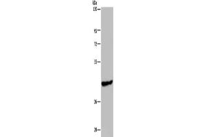 Gel: 8 % SDS-PAGE, Lysate: 40 μg, Lane: Mouse skeletal muscle tissue, Primary antibody: ABIN7191867(PHKG1 Antibody) at dilution 1/200, Secondary antibody: Goat anti rabbit IgG at 1/8000 dilution, Exposure time: 1 minute (PHKG1 Antikörper)
