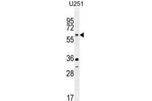 TNFRSF1A Antibody (N-term) western blot analysis in U251 cell line lysates (35 µg/lane).