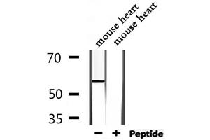 Western Blotting (WB) image for anti-WAS Protein Family, Member 3 (WASF3) (Internal Region) antibody (ABIN6257552)