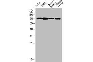 Western blot analysis of varias lysis using F13B antibody. (F13B Antikörper  (Internal Region))