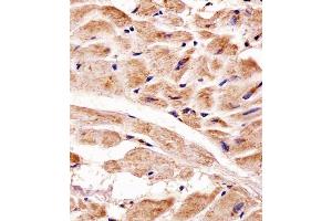 Immunohistochemical analysis of paraffin-embedded H. (PINK1 Antikörper)