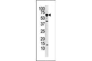 Image no. 2 for anti-Protein Phosphatase 3, Catalytic Subunit, alpha Isoform (PPP3CA) (N-Term) antibody (ABIN360808)