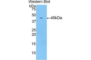 Western blot analysis of the recombinant protein. (LCN8 Antikörper  (AA 25-176))