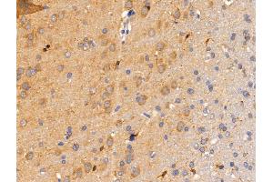 Siglec 7 Antibody at 1/100 staining Rat brain tissue by IHC-P.