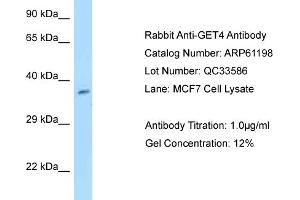 Western Blotting (WB) image for anti-Chromosome 7 Open Reading Frame 20 (C7orf20) (N-Term) antibody (ABIN2788715)