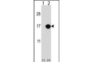 Western blot analysis of CDKN2B (arrow) using rabbit polyclonal CDKN2B Antibody (C-term) (ABIN656561 and ABIN2845822). (CDKN2B Antikörper  (C-Term))
