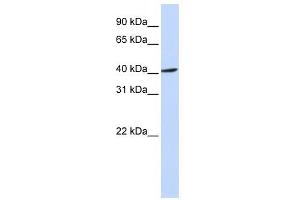 FBXO28 antibody used at 1 ug/ml to detect target protein. (FBXO28 Antikörper  (Middle Region))