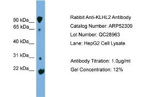 WB Suggested Anti-KLHL2  Antibody Titration: 0. (KLHL2 Antikörper  (Middle Region))