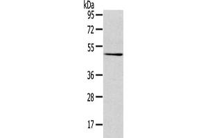 Gel: 8 % SDS-PAGE,Lysate: 40 μg,Primary antibody: ABIN7131404(TMPRSS4 Antibody) at dilution 1/500 dilution,Secondary antibody: Goat anti rabbit IgG at 1/8000 dilution,Exposure time: 3 minutes