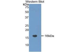 Western blot analysis of the recombinant protein. (NRARP Antikörper  (AA 3-109))