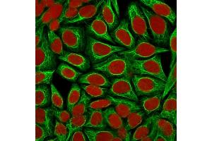 Confocal immunofluorescence image of HeLa cells using Cytokeratin 18 Mouse Monoclonal Antibody (KRT18/1190). (Cytokeratin 18 Antikörper)