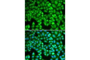 Immunofluorescence analysis of U2OS cells using WAS antibody. (WASP Antikörper  (AA 60-250))