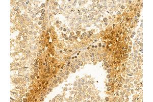 ABIN6265516 and ABIN6272982 at 1/100 staining Rat testis tissue by IHC-P. (TELO2 Antikörper  (Internal Region))