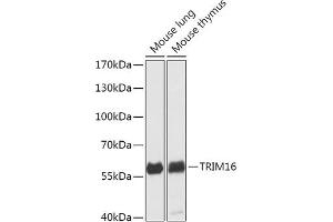 Western blot analysis of extracts of various cell lines, using TRIM16 antibody (ABIN7270978) at 1:1000 dilution. (TRIM16 Antikörper  (AA 1-210))