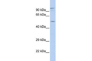 WB Suggested Anti-GJA3 Antibody Titration:  0. (GJA3 Antikörper  (N-Term))