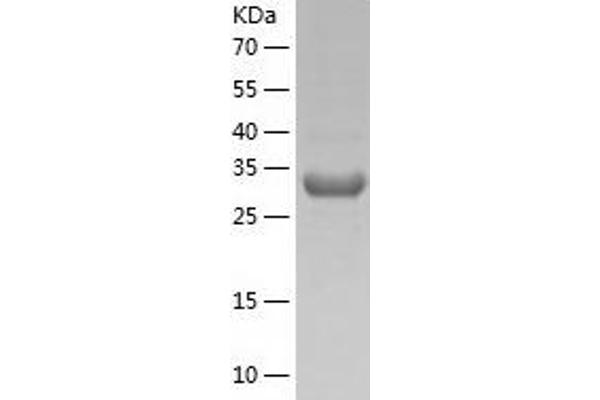 PECR Protein (AA 1-303) (His tag)