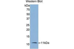 Western blot analysis of the recombinant protein. (IL-6 Receptor Antikörper  (AA 19-108))