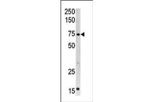 Image no. 1 for anti-Carnitine Palmitoyltransferase 2 (CPT2) (C-Term) antibody (ABIN357771) (CPT2 Antikörper  (C-Term))