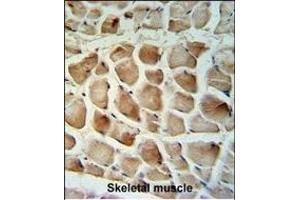 Calponin-3 Antibody (Center) (ABIN390504 and ABIN2840860) IHC analysis in formalin fixed and paraffin embedded human skeletal muscle tissue followed by peroxidase conjugation of the secondary antibody and DAB staining. (CNN3 Antikörper  (AA 129-158))