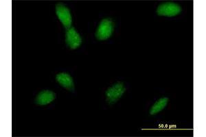Immunofluorescence (IF) image for anti-Mitogen-Activated Protein Kinase Kinase 4 (MAP2K4) (AA 1-399) antibody (ABIN520127)