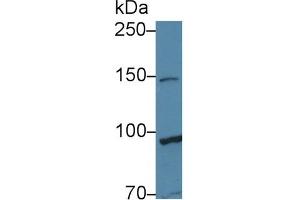 Western Blot; Sample: Human Hela cell lysate; Primary Ab: 1µg/ml Rabbit Anti-Human TAF2 Antibody Second Ab: 0. (TAF2 Antikörper  (AA 918-1199))