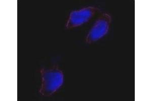 Immunofluorescence analysis of Oct4 antibody and HeLa cells. (OCT4 Antikörper  (AA 1-30))