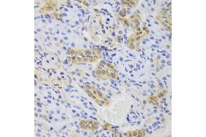 Immunohistochemistry (Paraffin-embedded Sections) (IHC (p)) image for anti-TSC22 Domain Family, Member 3 (TSC22D3) (AA 1-79) antibody (ABIN6149613)