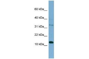 WB Suggested Anti-PHLDA2 Antibody Titration: 0.