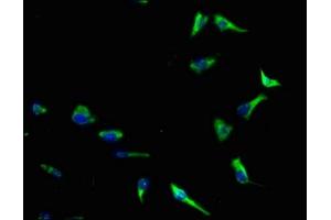 Immunofluorescence staining of SH-SY5Y cells with ABIN7143610 at 1:140, counter-stained with DAPI.