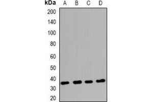 Western blot analysis of Claudin 17 expression in Raji (A), BT474 (B), K562 (C), mouse hrart (D) whole cell lysates.