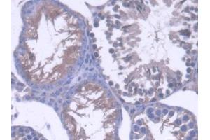 DAB staining on IHC-P; Samples: Mouse Testis Tissue (OS9 Antikörper  (AA 471-672))