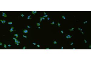 Immunofluorescence analysis of hela cell using SLC18A3 Polyclonal Antibody at dilution of 1:50 (SLC18A3 Antikörper)