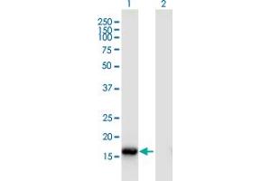 Western Blot analysis of ROBO3 expression in transfected 293T cell line by ROBO3 monoclonal antibody (M02), clone 2H1. (ROBO3 Antikörper  (AA 1-147))