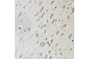 Immunohistochemistry of paraffin-embedded rat brain using MT-ND5 antibody (ABIN6135116, ABIN6144435, ABIN6144437 and ABIN6224158) at dilution of 1:100 (40x lens). (MT-ND5 Antikörper  (AA 500-600))
