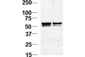 Western blot analysis of NL1 Antibody (N-term) 920b in Jurkat cell lysates. (NAP1L1 Antikörper  (N-Term))