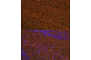 Immunofluorescence analysis of mouse brain using Mu Opioid Receptor(MOR) Rabbit pAb (ABIN7269101) at dilution of 1:100 (40x lens). (Mu Opioid Receptor 1 Antikörper  (C-Term))
